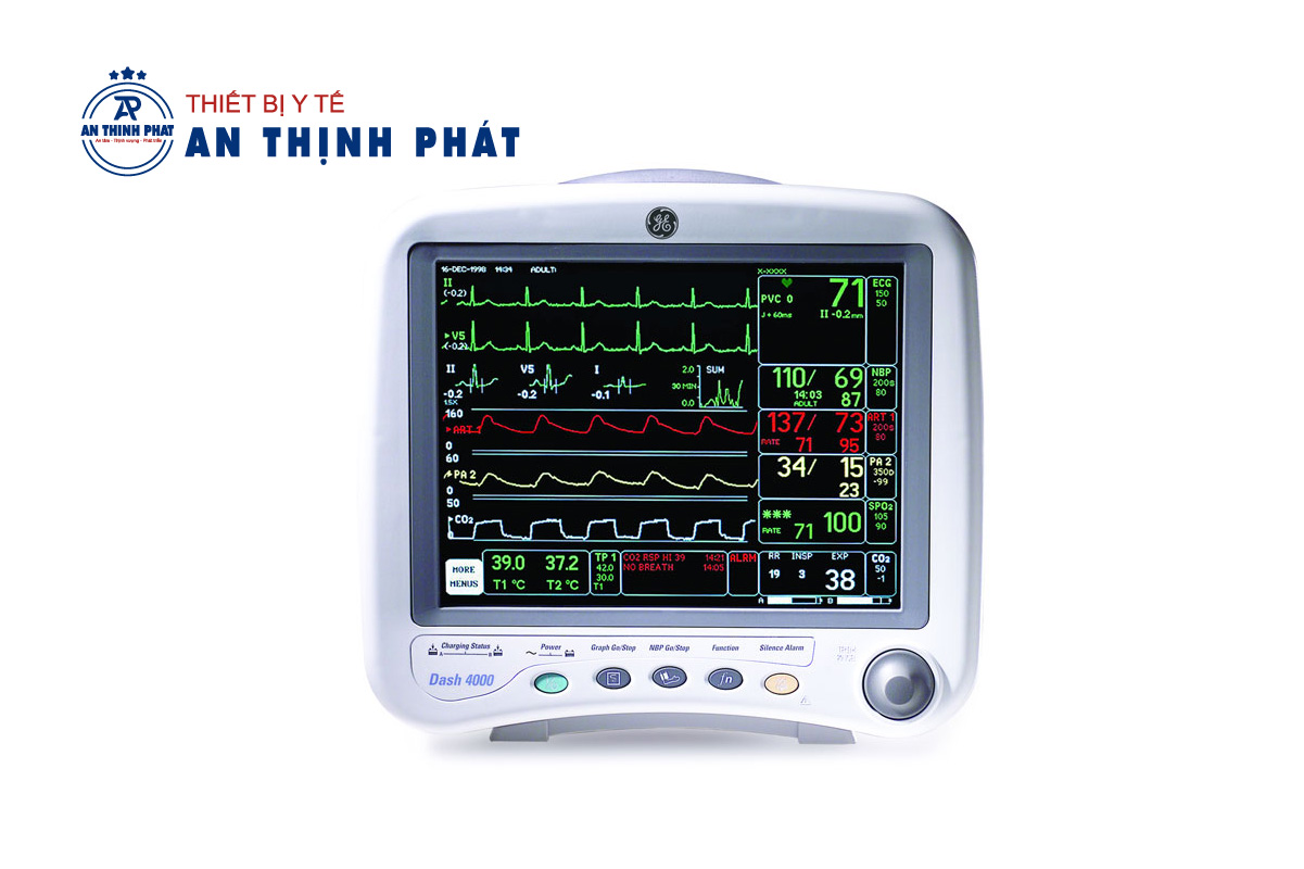 Cách đọc kết quả chạy máy monitor dạng sóng