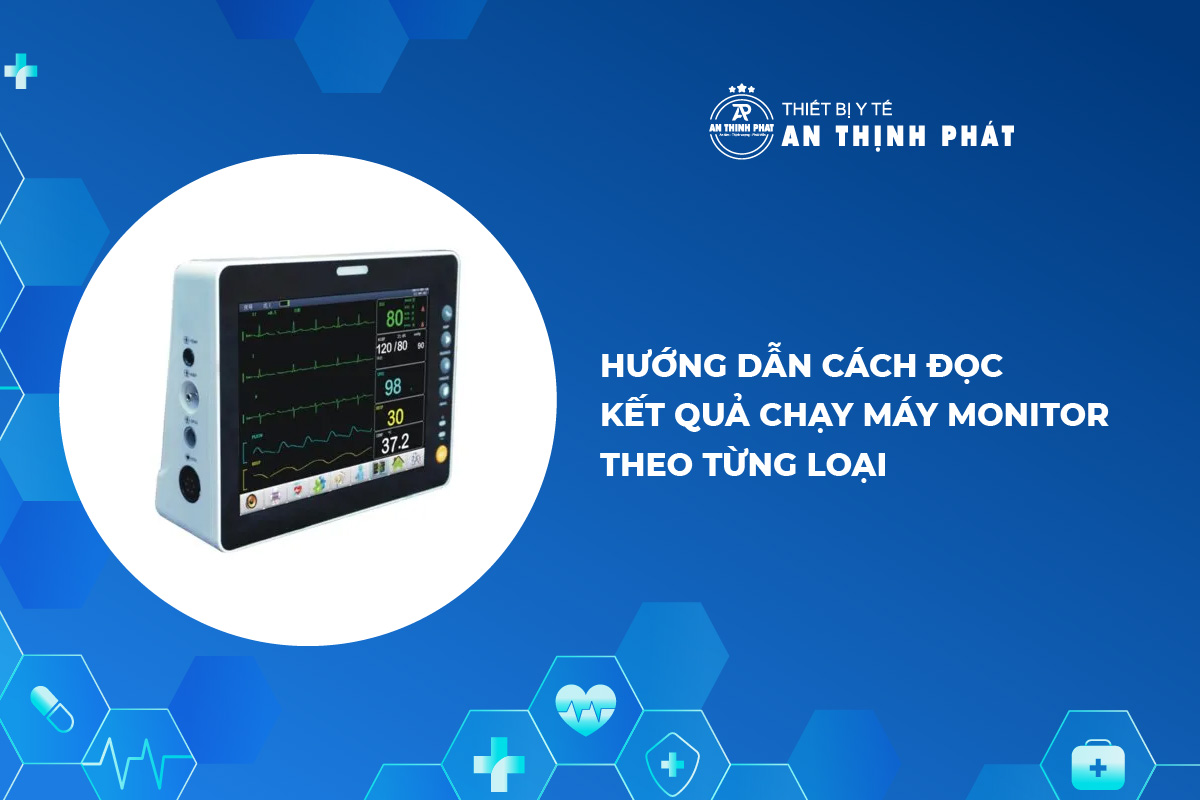 Hướng dẫn cách đọc kết quả chạy máy monitor theo từng loại