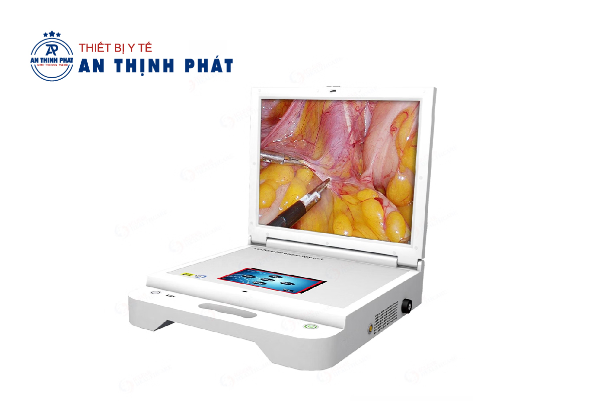 Máy nội soi tai mũi họng xách tay là gì?