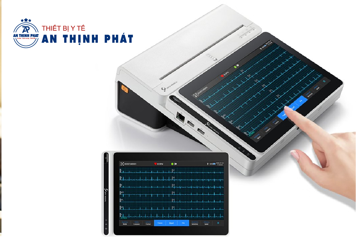 Cách đọc máy đo điện tim - Phân tích từng thành phần điện tâm đồ